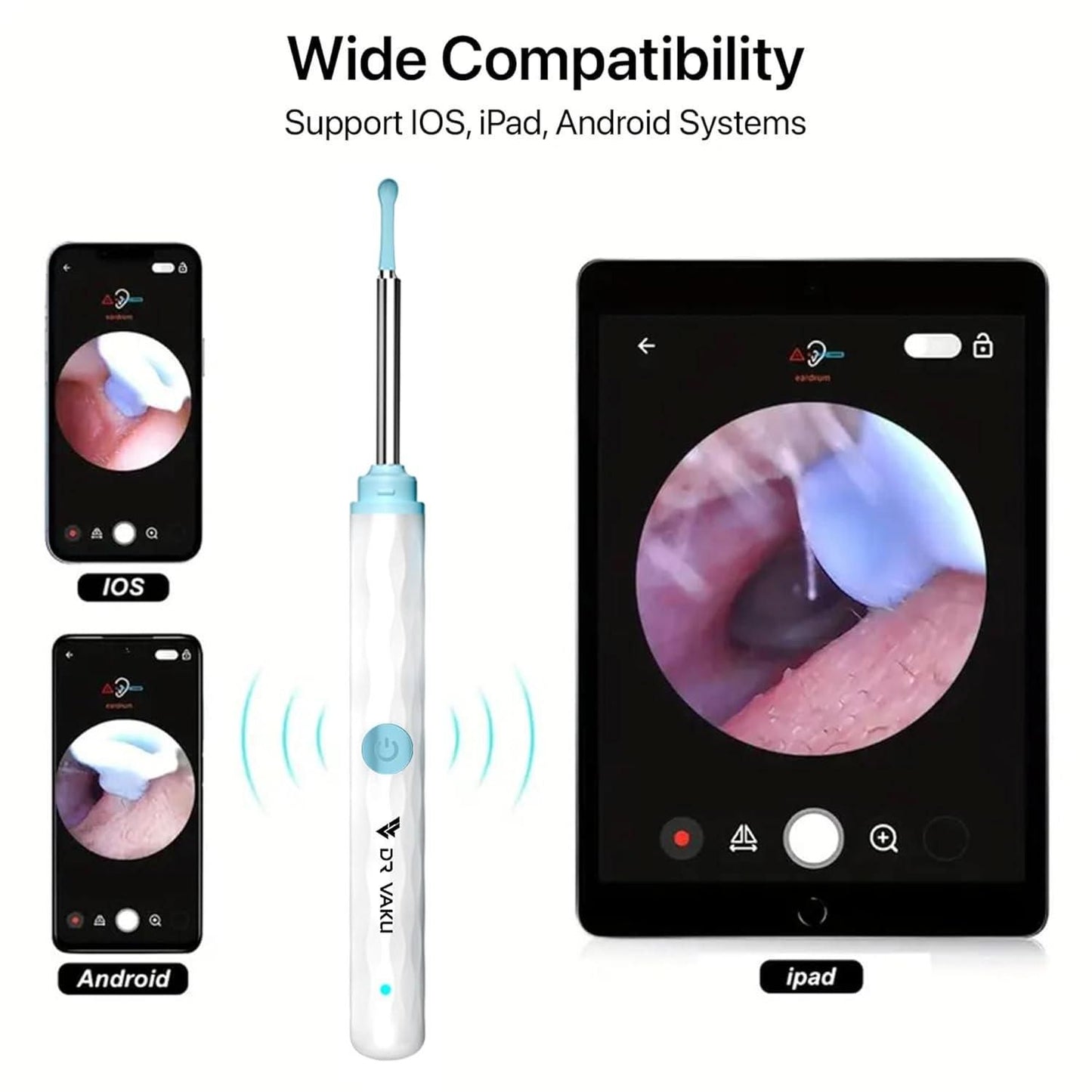 Smart Visual Ear Wax Cleaner - Utility Mart