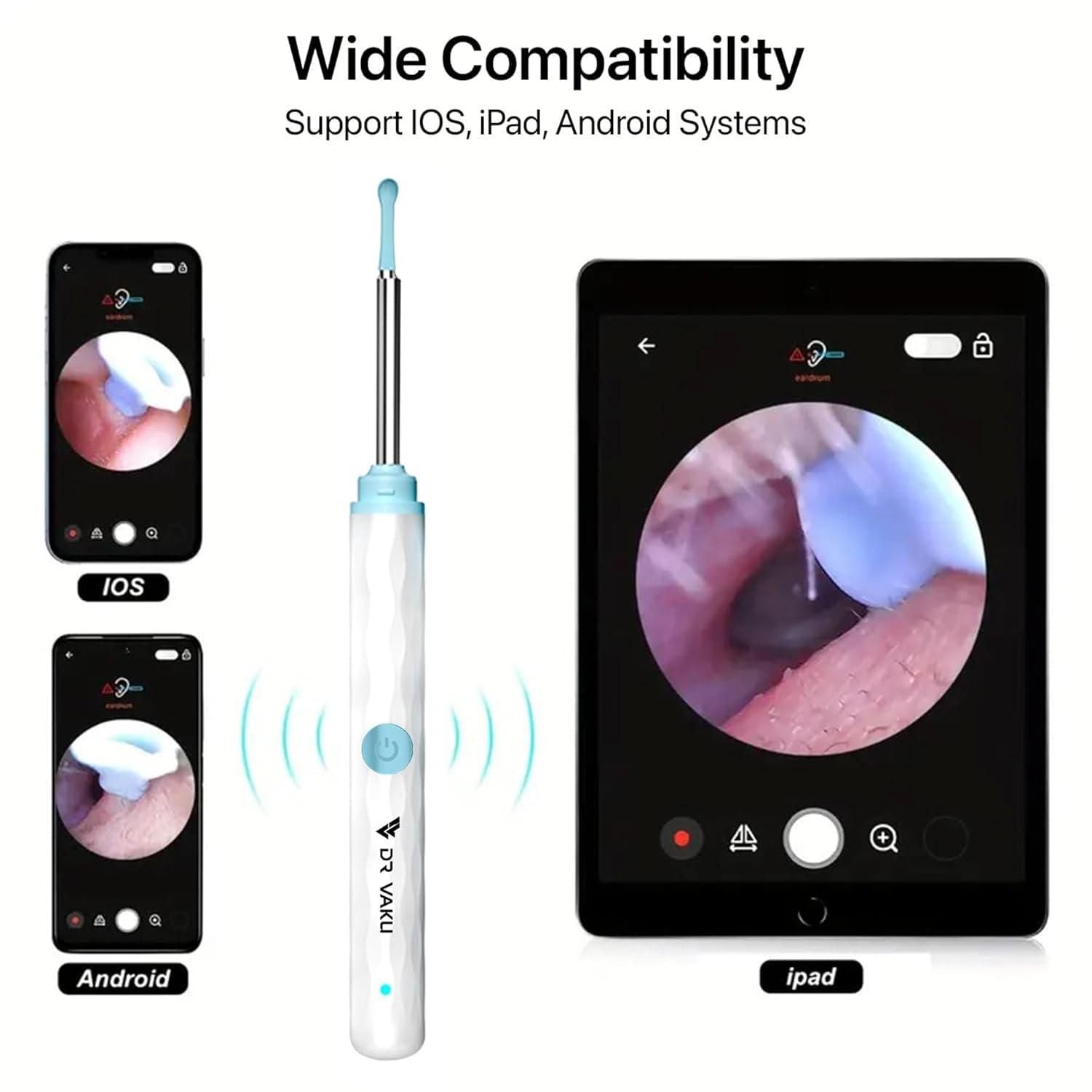 Smart Visual Ear Wax Cleaner - Utility Mart 