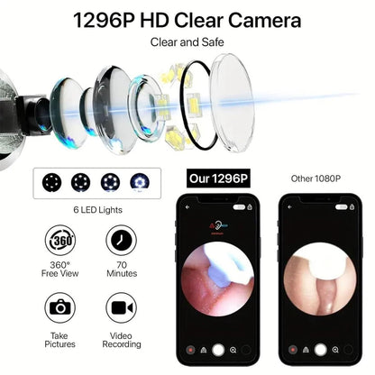 Smart Visual Ear Wax Cleaner - Utility Mart 